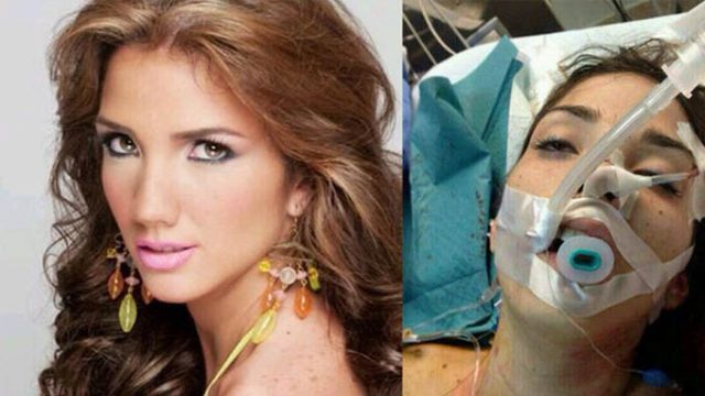 Hoa hậu Du lịch Genesis Carmona đã bị bắn trọng thương trong một cuộc biểu tình trên đường phố và chết sau đó một ngày. Ảnh: Internet