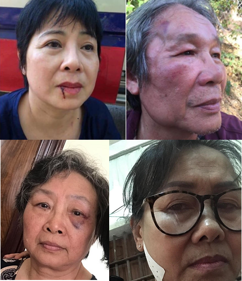 Một số trong nhiều nạn nhân của vụ khủng bố. Ảnh: Blog Nguyễn Tường Thụy