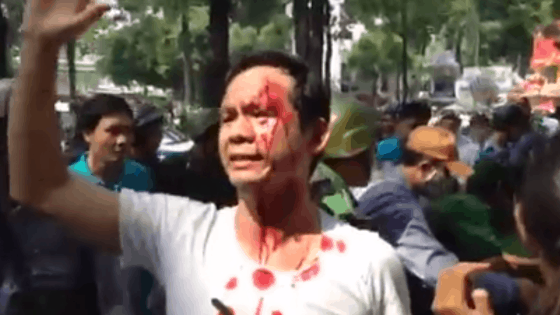 Anh Trần Bang (Sài Gòn) bị đánh khi anh tham gia biểu tình ngày 5/11/2015 phản đối trùm xâm lược Tập Cận Bình sang Việt Nam. Ảnh: Blog Nguyễn Tường Thụy - cắt từ video clip