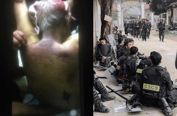 Cụ Lê Đình Kinh sau khi chết với nhiều vết bầm tím ở sau lưng sau vụ công an tấn công vào Đồng Tâm hôm 9/1/2020 (hình trái), và cảnh sát cơ động ở Đồng Tâm hôm 9/1/2020 (hình phải). Ảnh: RFA