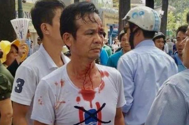 Kỹ sư Trần Bang bị hành hung đổ máu khi tham gia biểu tình chống Dự luật Đặc khu. Ảnh: FB Mạc Van Trang